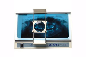 Velopex Hi Lite Viewer - стоматологический негатоскоп